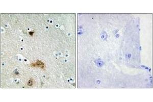 Immunohistochemistry analysis of paraffin-embedded human brain tissue, using LASS4 Antibody. (LASS4 Antikörper  (AA 41-90))