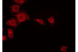 ABIN6275660 staining Hela by IF/ICC. (UBFD1 Antikörper  (Internal Region))