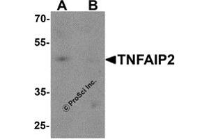 Western Blotting (WB) image for anti-Tumor Necrosis Factor, alpha-Induced Protein 2 (TNFAIP2) antibody (ABIN1077380) (TNFAIP2 Antikörper)
