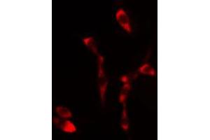 ABIN6267456 staining 293 cells by IF/ICC. (SHC1 Antikörper  (pTyr349))