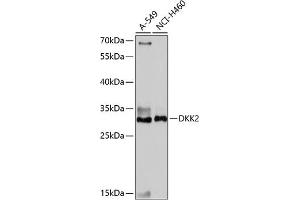 Western blot analysis of extracts of various cell lines, using DKK2 antibody (ABIN7266756) at 1:1000 dilution. (DKK2 Antikörper  (C-Term))