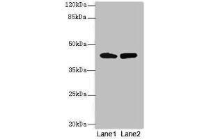 Western blot All lanes: NMUR1 antibody at 2 μg/mL Lane 1: Mouse liver tissue Lane 2: Mouse kidney tissue Secondary Goat polyclonal to rabbit IgG at 1/10000 dilution Predicted band size: 47 kDa Observed band size: 47 kDa (NMUR1 Antikörper  (AA 360-426))