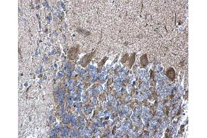 IHC-P Image RPL5 antibody detects RPL5 protein at cytoplasm on mouse hind brain by immunohistochemical analysis. (RPL5 Antikörper)