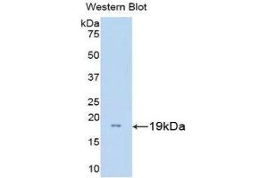 Western Blotting (WB) image for anti-Gonadotropin-Releasing Hormone 1 (Luteinizing-Releasing Hormone) (GNRH1) (AA 22-140) antibody (FITC) (ABIN1859037) (GNRH1 Antikörper  (AA 22-140) (FITC))
