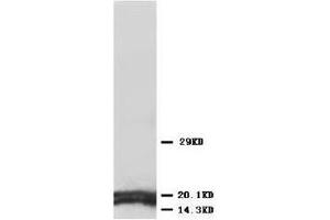 Western blot analysis of rat tissue sections (kidney) lysis using AQP1 antibody (Aquaporin 1 Antikörper  (C-Term))