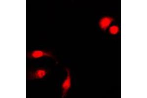 Immunofluorescent analysis of NF-kappaB p105 (pS927) staining in HeLa cells. (NFKB1 Antikörper  (C-Term, pSer927))
