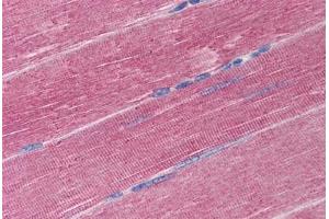 Human Skeletal Muscle (formalin-fixed, paraffin-embedded) stained with ADAM17 antibody ABIN290260 at 20 ug/ml followed by biotinylated goat anti-rabbit IgG secondary antibody ABIN481713, alkaline phosphatase-streptavidin and chromogen. (ADAM17 Antikörper  (C-Term))
