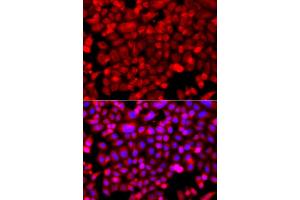Immunofluorescence analysis of A549 cells using NDUFV1 antibody (ABIN5974962). (NDUFV1 Antikörper)