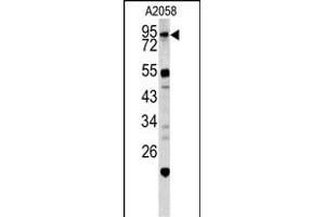 Western blot analysis of CALD1 antibody (Center) (ABIN390542 and ABIN2840882) in  cell line lysates (35 μg/lane). (Caldesmon Antikörper  (AA 428-457))