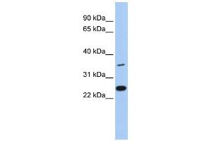 WB Suggested Anti-LYVE1 Antibody Titration: 0. (LYVE1 Antikörper  (N-Term))