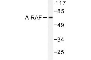 Image no. 1 for anti-V-Raf Murine Sarcoma 3611 Viral Oncogene Homolog (ARAF) antibody (ABIN271994) (ARAF Antikörper)