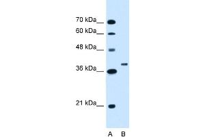 WB Suggested Anti-RNF146 Antibody Titration:  1. (RNF146 Antikörper  (C-Term))