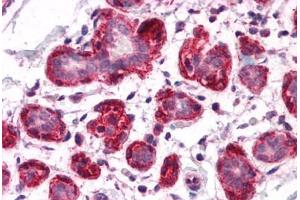 Human Breast: Formalin-Fixed, Paraffin-Embedded (FFPE) (SH3BP4 Antikörper  (C-Term))