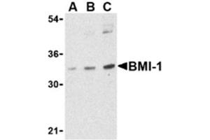 Image no. 1 for anti-BMI1 Polycomb Ring Finger Oncogene (BMI1) (Middle Region) antibody (ABIN318769) (BMI1 Antikörper  (Middle Region))