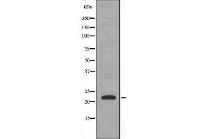 Western blot analysis of extracts from HeLa using CRP1 antibody. (CSRP1 Antikörper  (Internal Region))