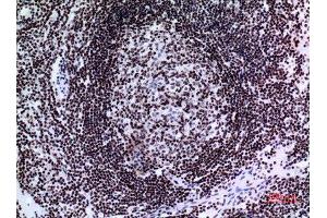 Immunohistochemistry (IHC) image for anti-Tumor Protein P73 (TP73) (Tyr221) antibody (ABIN3187855)