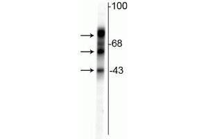 Western blot of rat cortical lysate showing specific immunolabeling of the ~48 kDa, ~65 kDa & ~75 kDa tau isoforms. (MAPT Antikörper)
