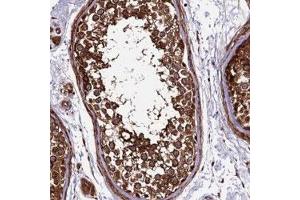 Immunohistochemical staining of human testis with LSM7 polyclonal antibody  shows strong cytoplasmic positivity in cells in seminiferus duct. (LSM7 Antikörper)