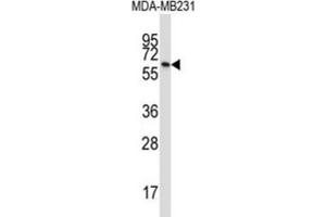 Western Blotting (WB) image for anti-Butyrophilin, Subfamily 3, Member A1 (BTN3A1) antibody (ABIN2997361) (BTN3A1 Antikörper)