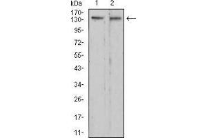 Western blot analysis using RAD50 mouse mAb against C6 (1) and HepG2 (2) cell lysate. (RAD50 Antikörper  (AA 228-359))