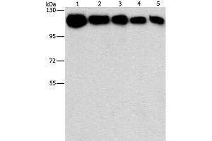 Western Blot analysis of A431, K562, 231, hela and hepG2 cell using HK2 Polyclonal Antibody at dilution of 1:1200 (Hexokinase 2 Antikörper)