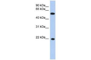 Crystallin Gamma C antibody used at 1 ug/ml to detect target protein. (CRYGC Antikörper  (Middle Region))