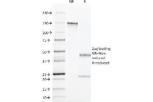 SDS-PAGE Analysis Purified TGF alpha Mouse Monoclonal Antibody (MF9). (TGFA Antikörper  (C-Term))
