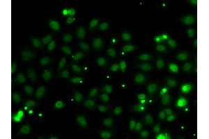Immunofluorescence analysis of MCF-7 cells using NGFRAP1 antibody (ABIN5974398). (Nerve Growth Factor Receptor (TNFRSF16) Associated Protein 1 (NGFRAP1) Antikörper)