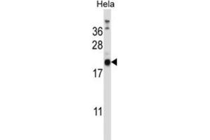 Western Blotting (WB) image for anti-Proline Rich Gla (G-Carboxyglutamic Acid) 1 (PRRG1) antibody (ABIN2997291) (PRRG1 Antikörper)