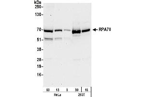 Western Blotting (WB) image for anti-Replication Protein A1, 70kDa (RPA1) (AA 350-400) antibody (ABIN7453556) (RPA1 Antikörper  (AA 350-400))