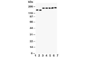 Western blot testing of DCC antibody and Lane 1:  rat brain (DCC Antikörper  (AA 162-178))