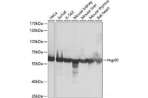 Western blot analysis of extracts of various cell lines using Hsp60 Polyclonal Antibody at dilution of 1:1000. (HSPD1 Antikörper)