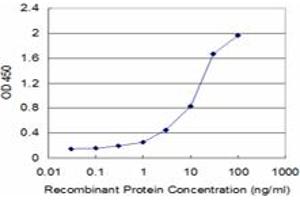 Detection limit for recombinant GST tagged STK17A is approximately 1ng/ml as a capture antibody.