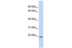 Image no. 1 for anti-Sex Comb On Midleg-Like 1 (SCML1) (N-Term) antibody (ABIN6740560) (SCML1 Antikörper  (N-Term))