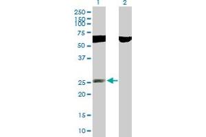 Western Blot analysis of RNF141 expression in transfected 293T cell line by RNF141 MaxPab polyclonal antibody. (RNF141 Antikörper  (AA 1-230))