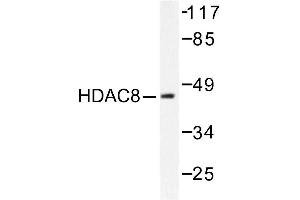 Image no. 1 for anti-Histone Deacetylase 8 (HDAC8) antibody (ABIN265460) (HDAC8 Antikörper)