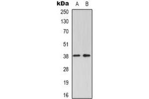 Western blot analysis of GRAP2 expression in K562 (A), Jurkat (B) whole cell lysates. (GRAP2 Antikörper)