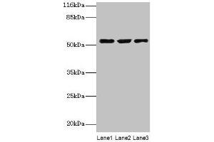 Western blot All lanes: CRNN antibody at 12 μg/mL Lane 1: HepG2 whole cell lysate Lane 2: Mouse heart tissue Lane 3: Rat skeletal muscle tissue Secondary Goat polyclonal to rabbit IgG at 1/10000 dilution Predicted band size: 54 kDa Observed band size: 54 kDa (CRNN Antikörper  (AA 139-389))