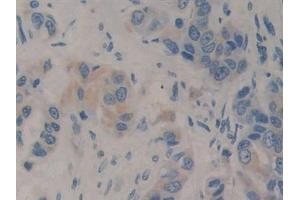 Immunohistochemistry (IHC) image for anti-Insulin-Like Growth Factor 1 (IGF1) (AA 49-118) antibody (ABIN7442501)