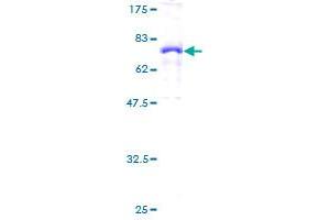 Complement Factor H Protein (CFH) (AA 20-449) (GST tag)