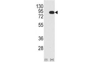 Western blot analysis B-RAF antibody and 293 cell lysate (2 ug/lane) either nontransfected (Lane 1) or transiently transfected with the BRAF gene (2). (BRAF Antikörper  (AA 379-408))