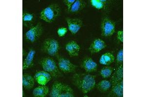 IF analysis of DGCR8 using anti-DGCR8 antibody (ABIN5692841). (DGCR8 Antikörper  (AA 561-762))