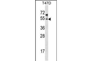 Western blot analysis in T47D cell line lysates (35ug/lane). (ZDHHC6 Antikörper  (C-Term))