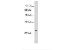 Image no. 1 for anti-Cleavage and Polyadenylation Specific Factor 4, 30kDa (CPSF4) (C-Term) antibody (ABIN6736285) (CPSF4 Antikörper  (C-Term))