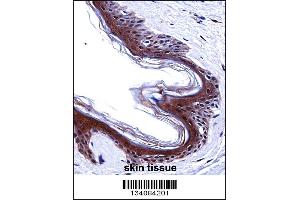 SMARCE1 Antibody immunohistochemistry analysis in formalin fixed and paraffin embedded human skin tissue followed by peroxidase conjugation of the secondary antibody and DAB staining.