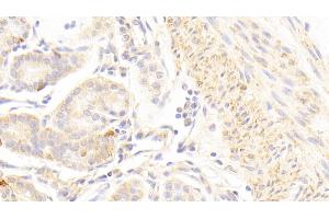 Detection of GRM1 in Human Stomach Tissue using Polyclonal Antibody to Glutamate Receptor, Metabotropic 1 (GRM1) (Metabotropic Glutamate Receptor 1 Antikörper  (AA 165-592))