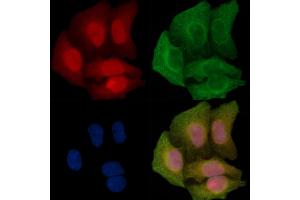 Phospho-MEKK1 (Thr1400) Antibody staining Hela cells(45 min of heat-shock treatment) by IF/ICC.