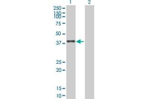Western Blot analysis of ZNF783 expression in transfected 293T cell line by ZNF783 MaxPab polyclonal antibody. (ZNF783 Antikörper  (AA 1-281))