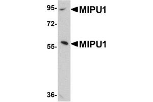 Western Blotting (WB) image for anti-Zinc Finger Protein 667 (ZNF667) (N-Term) antibody (ABIN1031458) (ZNF667 Antikörper  (N-Term))