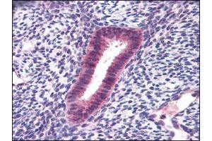 Human Uterus: Formalin-Fixed, Paraffin-Embedded (FFPE) (FOXN1 Antikörper)